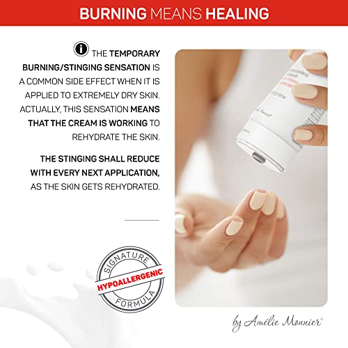 DermaCalm SOS Therapy - Face and Body Cream for Severe dry and Eczema-prone Skin
