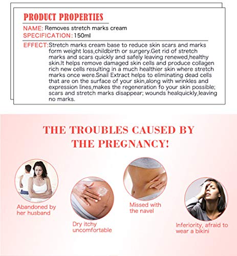 AICHUN BEAUTY Pregnancy Cream Streach Mark Remover Scars Repair Cellulites Lotion Cream 150ml
