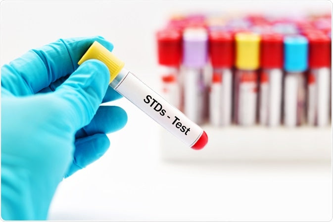 ALL YOU NEED TO KNOW ABOUT STIs